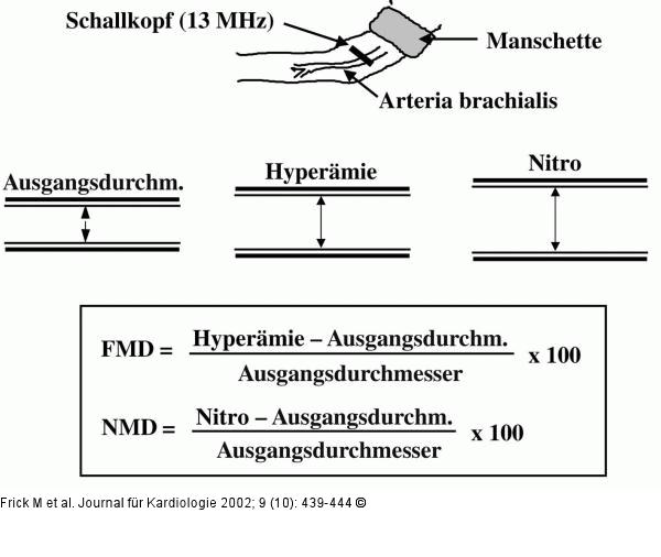 Endothelfunktion - Arteria brachialis