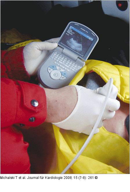 Ultraschallgerät