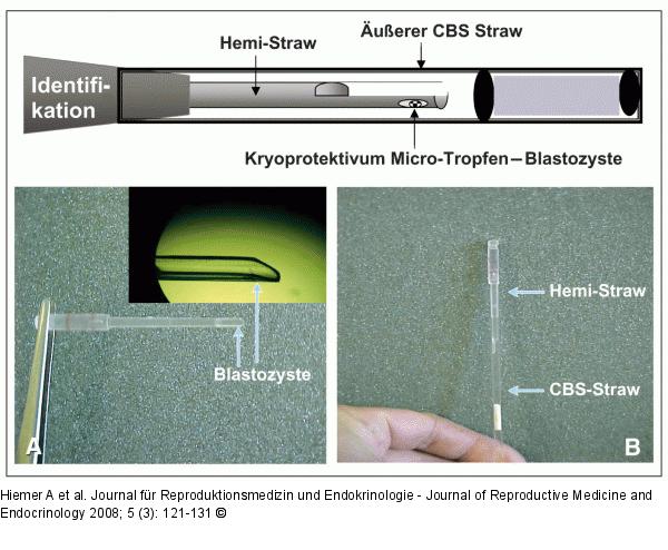 Hemi-Straw - CBS-Straw