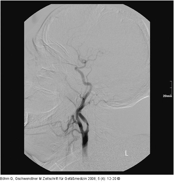 Angiographie