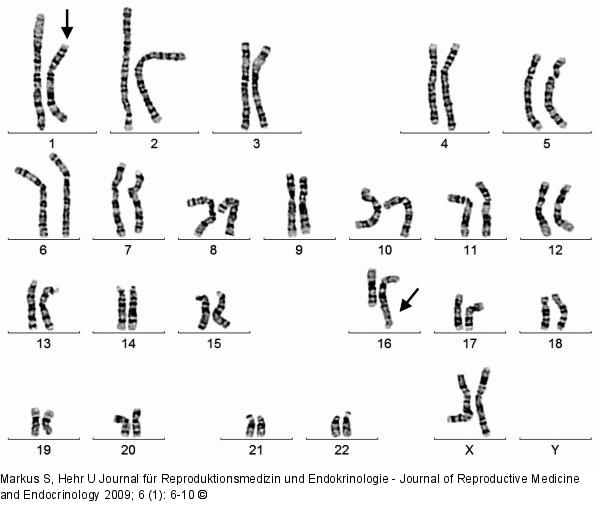 Female karyotype
