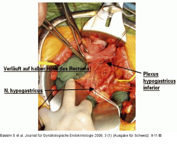 Operationssitus