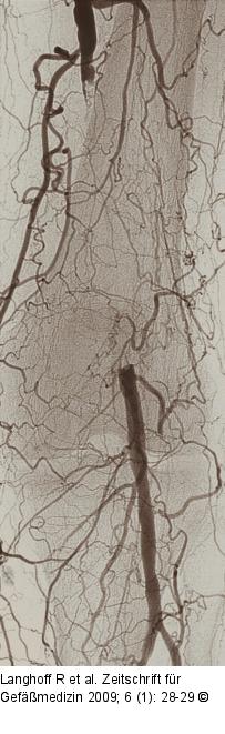 Arteria poplitea