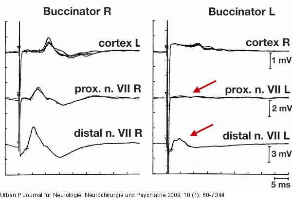 Potenziale