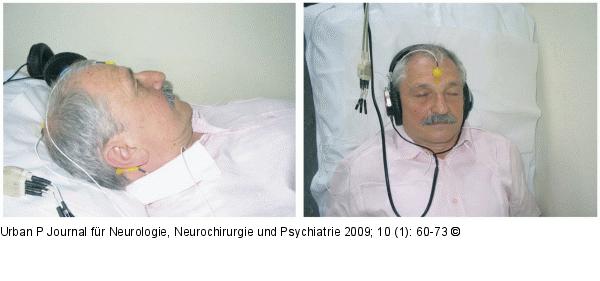 Ableitelektroden