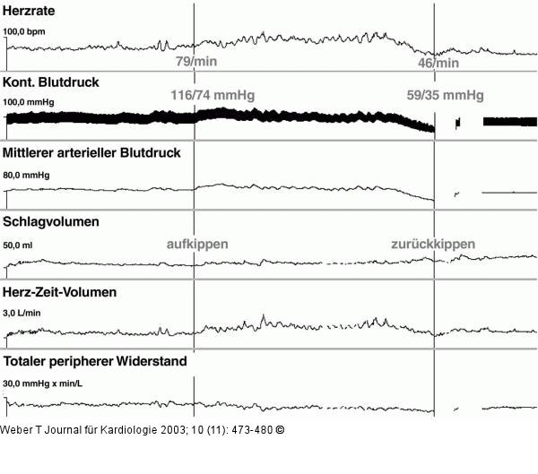 Kipptisch - Untersuchung