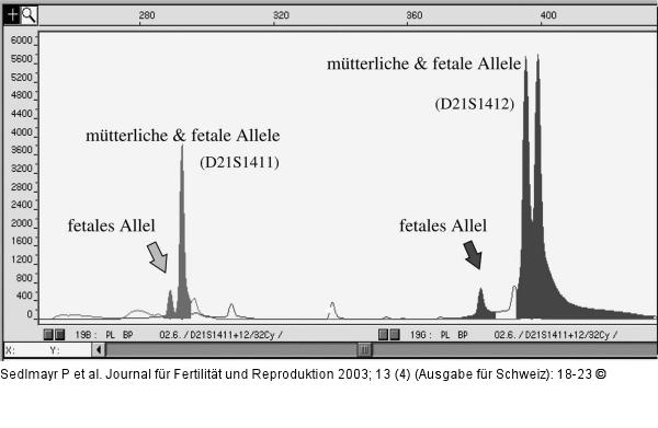 Fetale DNA - mütterliche DNA