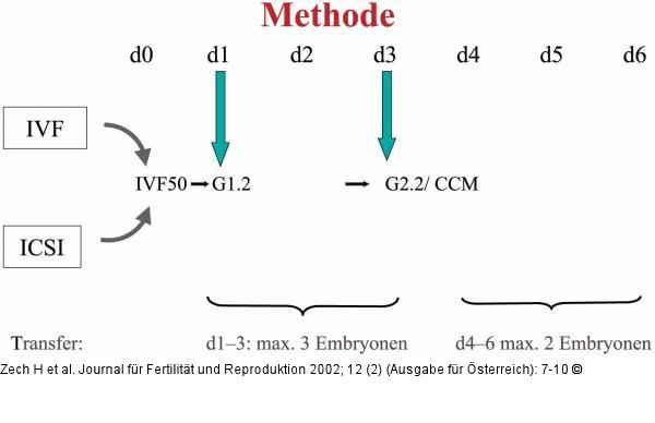 In-vitro-Fertilisierung - Chronologie