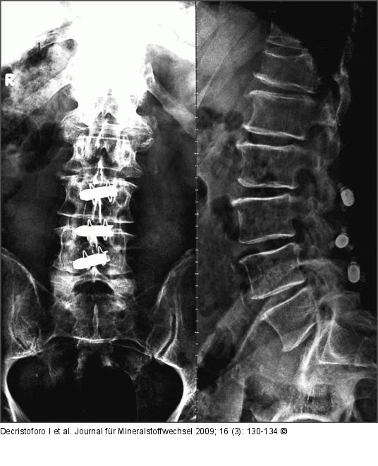 Wirbelsäulenchirurgie