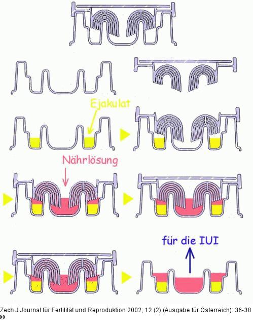 Spermselector
