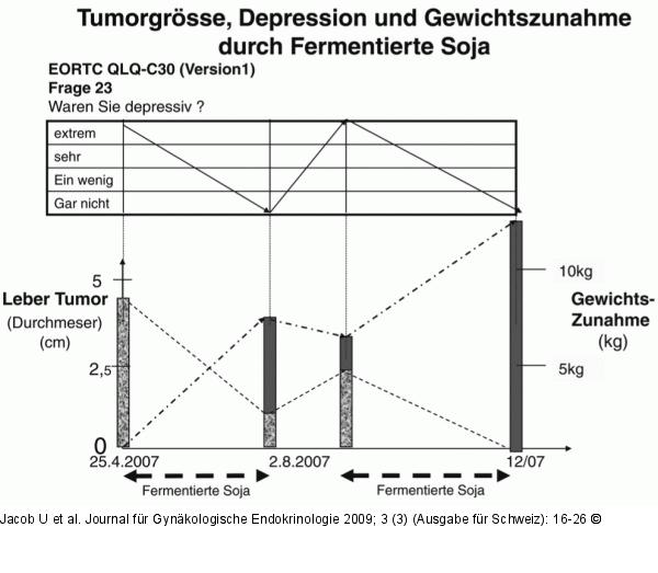 Tumorgröße - Depression - Gewicht