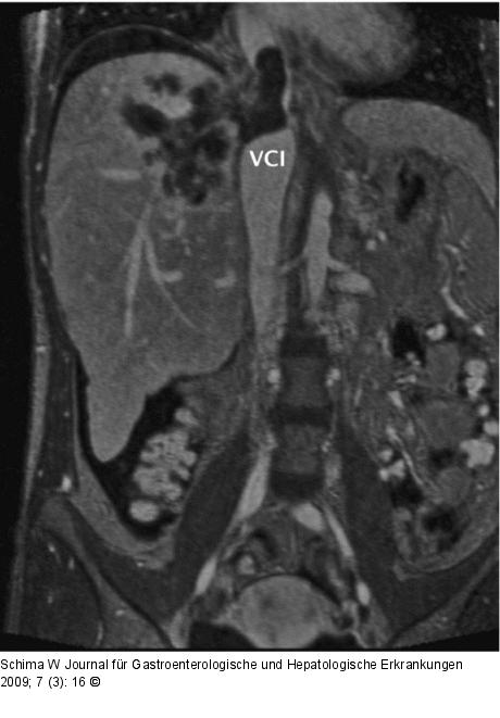 MR-Angiographie