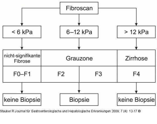 Fibroscan