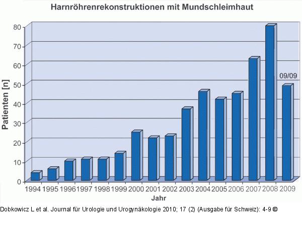 Harnröhrenrekonstruktion