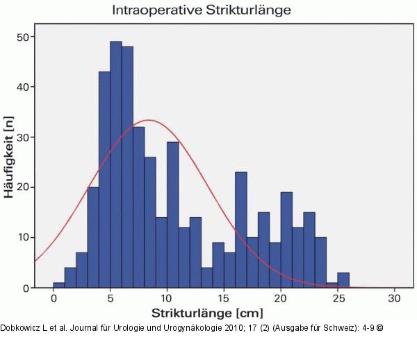 Inoperative Strikturlänge