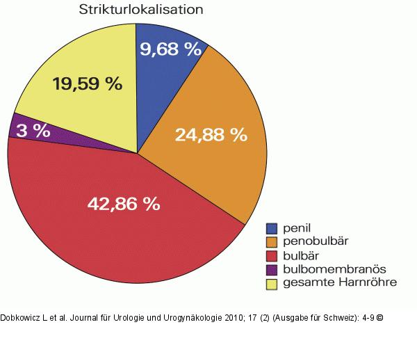 Strikturlokalisation