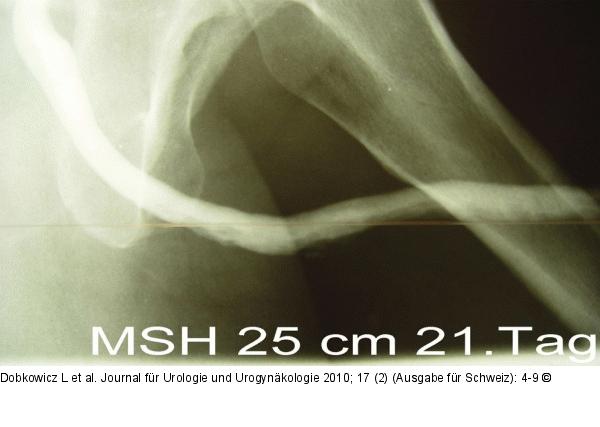 Urethrogramm - Postoperativ