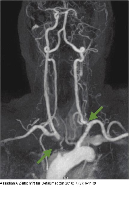 MR-Angiographie
