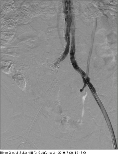 Angiogramm