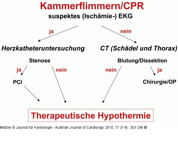 Kammerflimmern