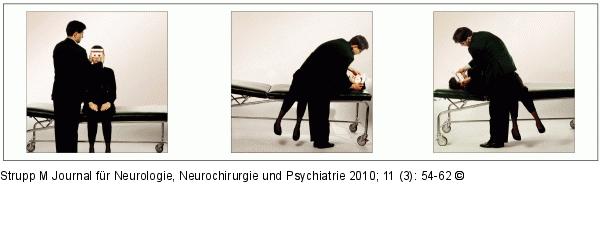 BPPV