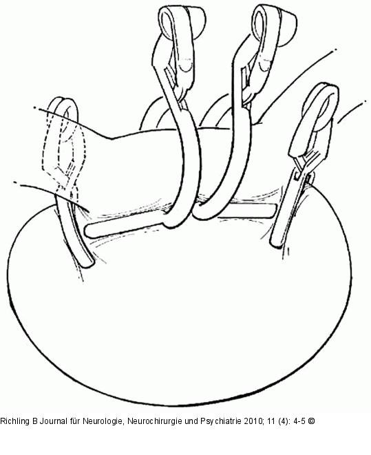 Clip-Position