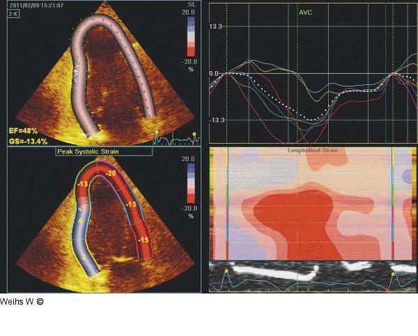 Strain-Analyse