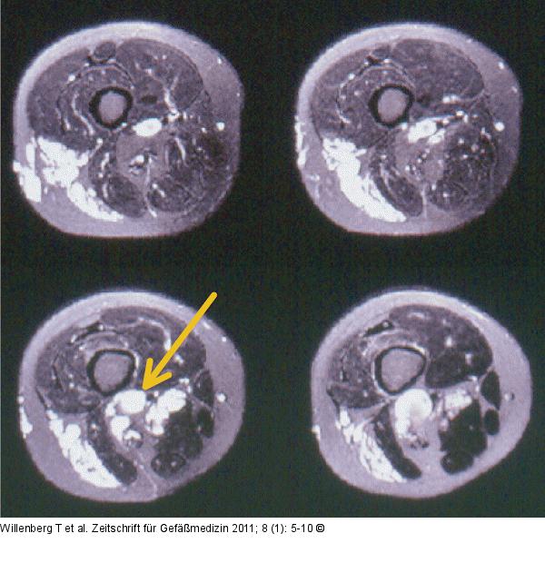 MR-Angiographie