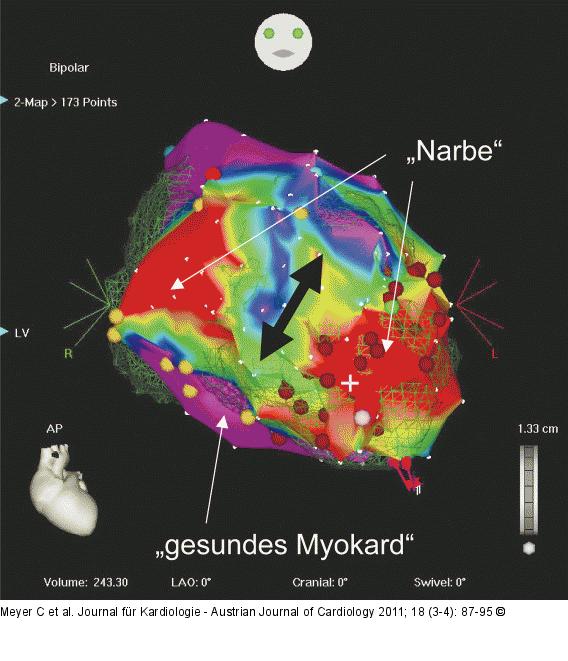 Substrat Mapping