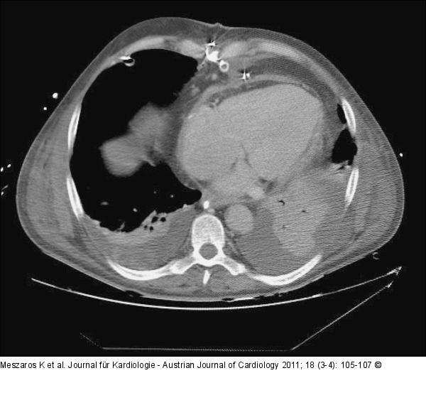 Thorax