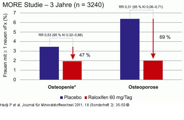 Raloxifen