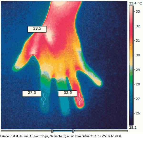 Thermographische Aufnahme