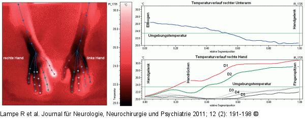 Kälteexpositionstest