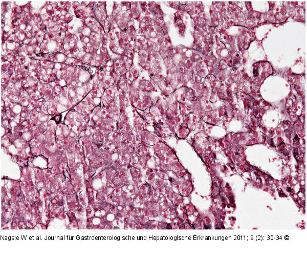 Histologie aus Leberstanzbiopsien