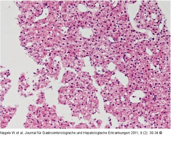 Histologischer Schnitt eines Stanzzylinders