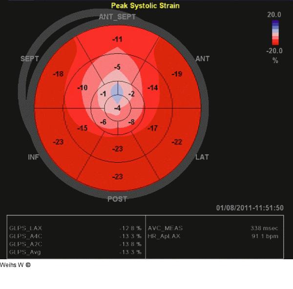 Bull's Eye-View
