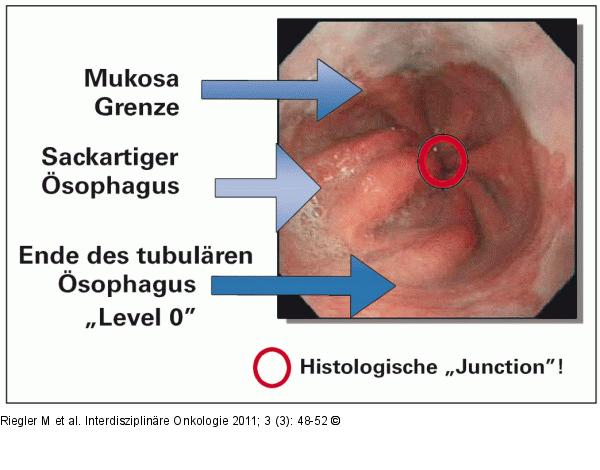 Ösophagus
