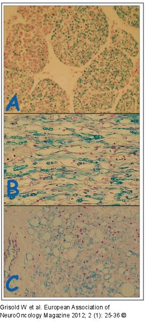 Nerve Roots