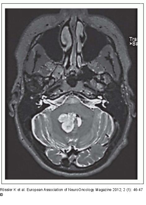 Axial Image