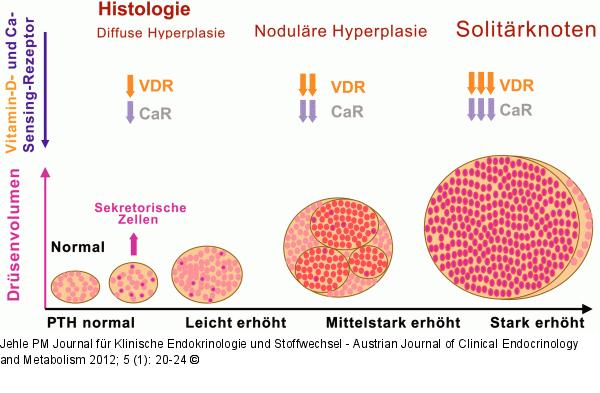 Nebenschilddrüse