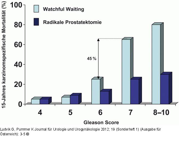 Prostatektomie