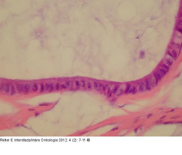 Appendix - Neoplasma