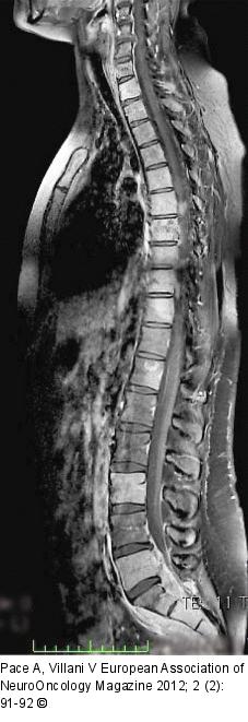 Spine