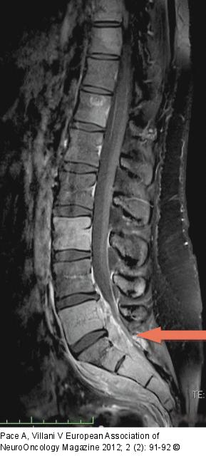 Spine