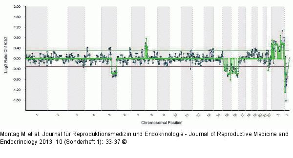 Result of an array-CGH analysis