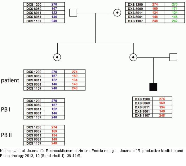 Polar body diagnosis of haemophilia A