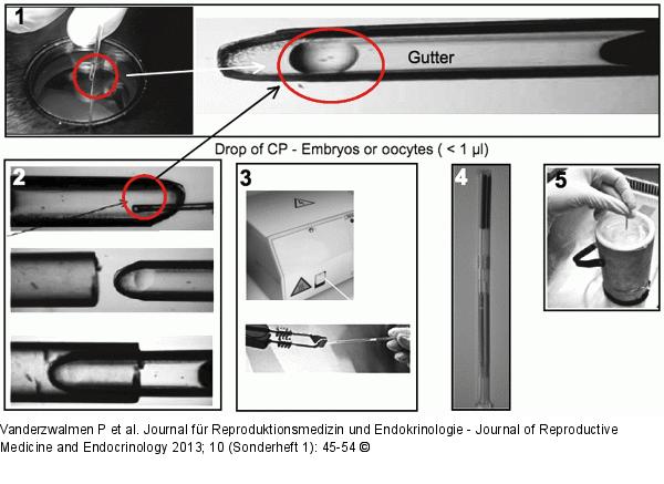 Vitrification procedure