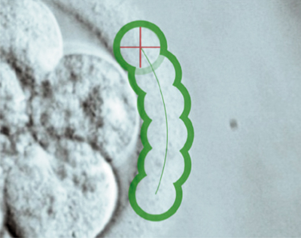 Produkt: Saturn 5 Active Laser<br>Vetrieb: GYNEMED Medizinprodukte GmbH & Co. KG