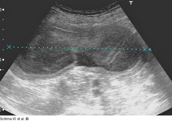 Sonographie