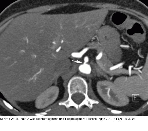MDCT-Angiographie